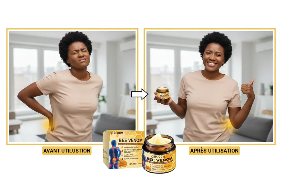STOP LES DOULEUR EN 3 JOURS AVEC LA CREME AU VENIN D'ABEILLE