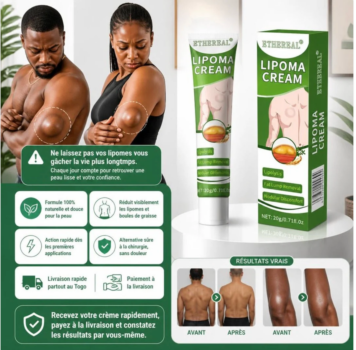 Éliminez vos lipomes et boules de graisse naturellement sans chirurgie
