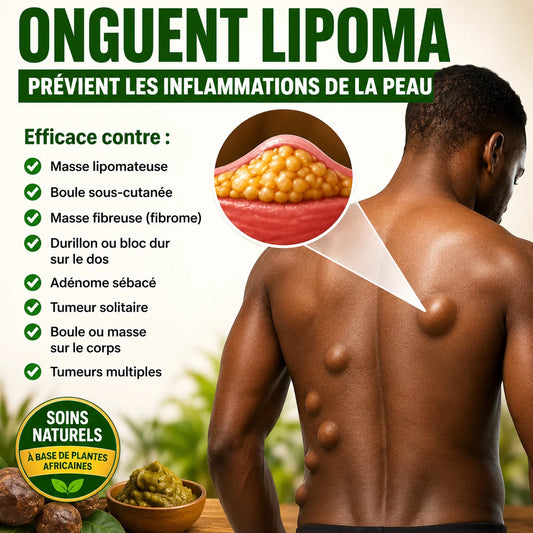 DITES ADIEU AUX LIPOMES, AUX KYSTES ET A TOUT TYPES DE BOULES