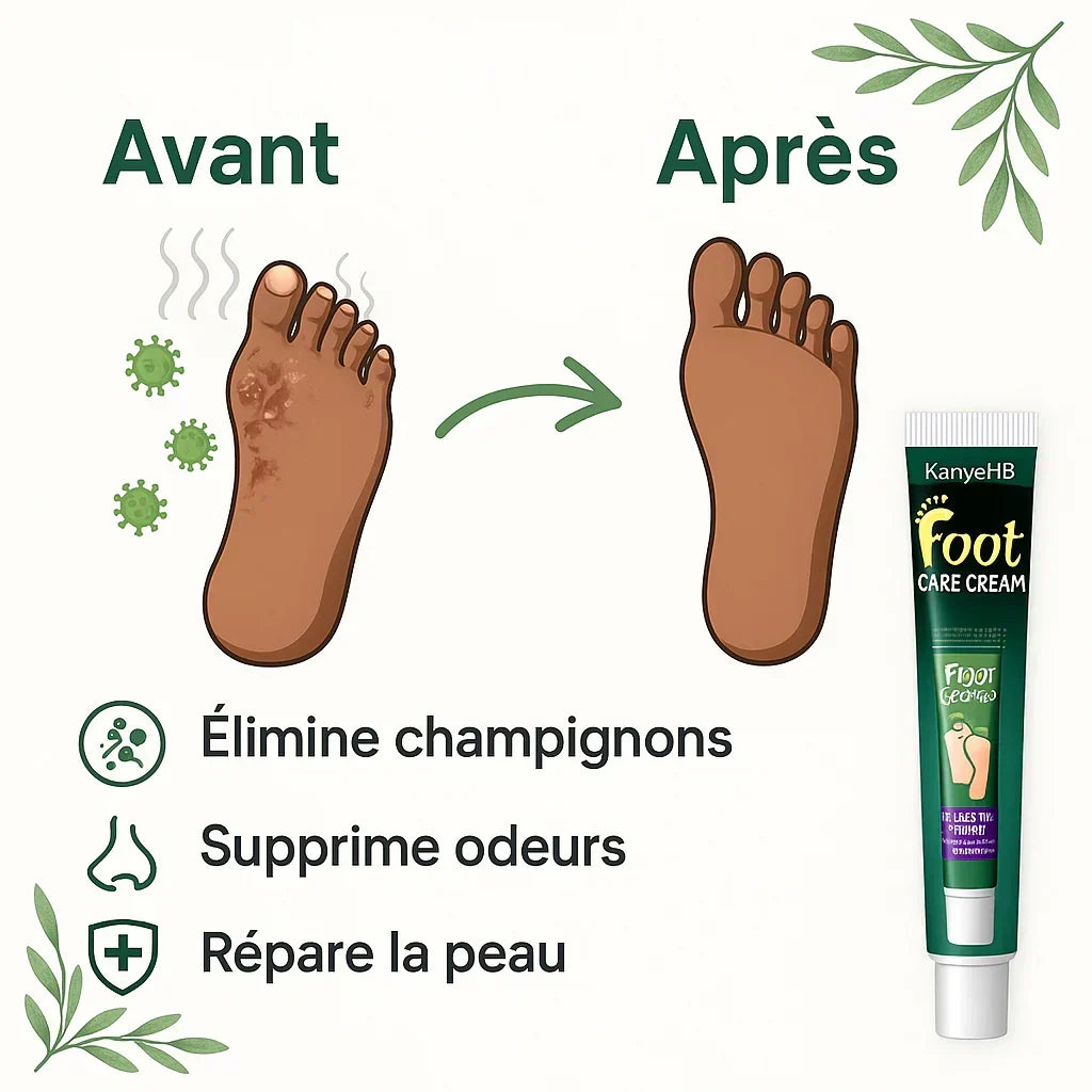 Pommade de confort pour les pieds – Bien-être quotidien [CA]